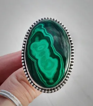 Malachite Ring