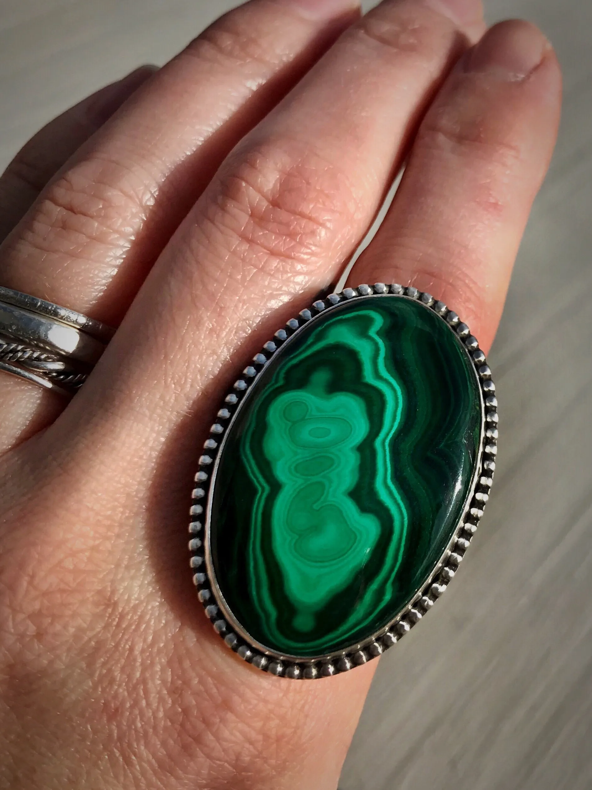 Malachite Ring