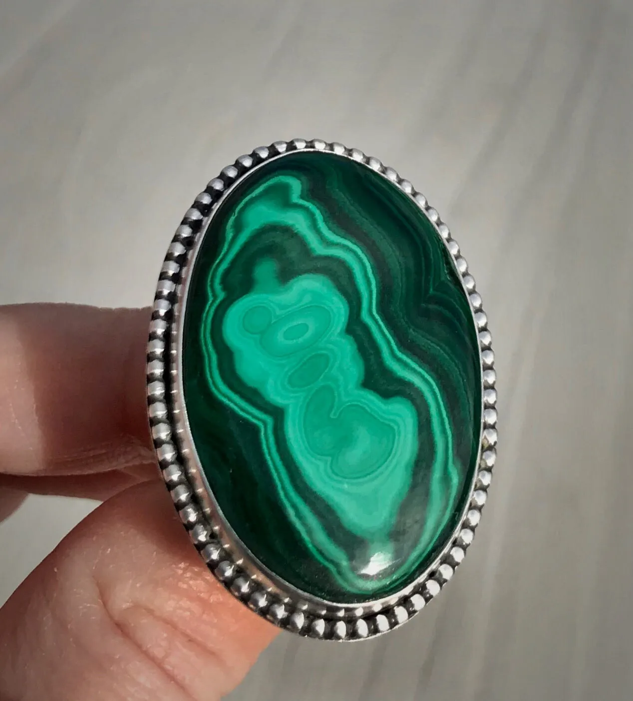 Malachite Ring
